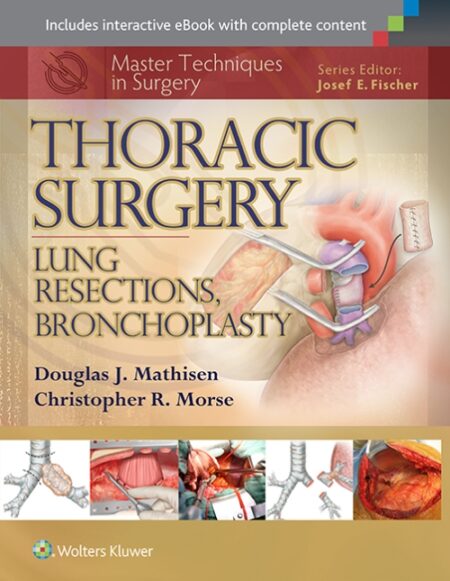 Master Techniques in Surgery: Thoracic Surgery: Lung Resections, Bronchoplasty 2015