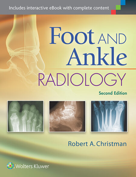 Foot and Ankle Radiology 2/E 2015
