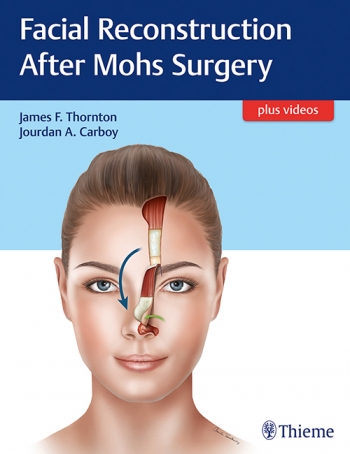 Facial Reconstruction After Mohs Surgery 2018