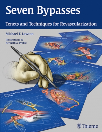Seven Bypasses: Tenets and Techniques for Revascularization 2018
