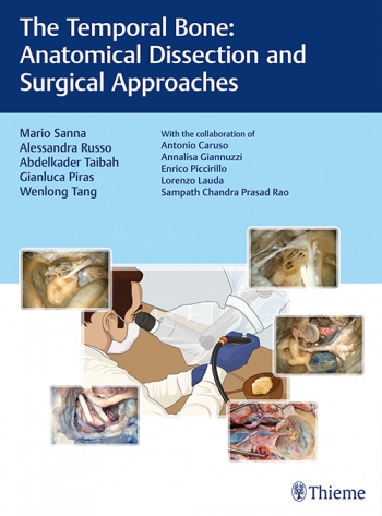 The Temporal Bone: Anatomical Dissection and Surgical Approaches 1st Edition 2018