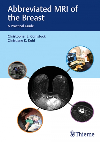 Abbreviated MRI of the Breast: A Practical Guide 2018