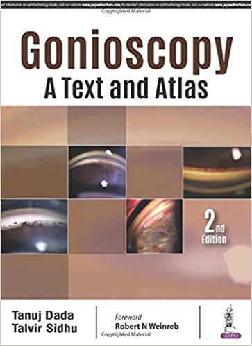 Gonioscopy: A Text and Atlas 2nd Edition