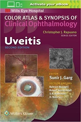 Wills Eye Hospital : Uveitis(Color Atlas of Synopsis of Clinical Ophthalmology) 2/E 2019