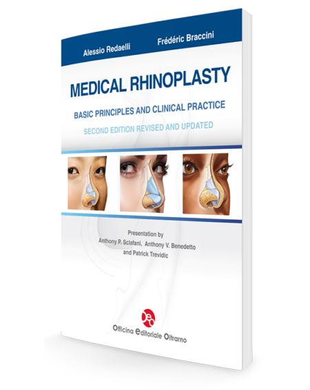 Medical Rhinoplasty : Basic Principles and Clinical Practice 2/E