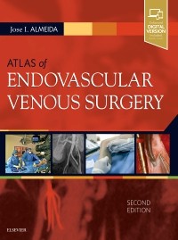 Atlas of Endovascular Venous Surgery 2nd Edition 2019