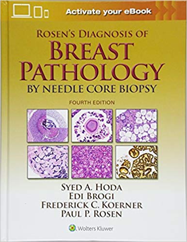 Rosen's Diagnosis of Breast Pathology by Needle Core Biopsy 4/E