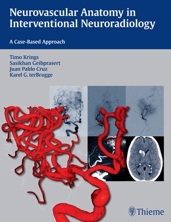 Neurovascular Anatomy in Interventional Neuroradiology: A Case-Based Approach 2015