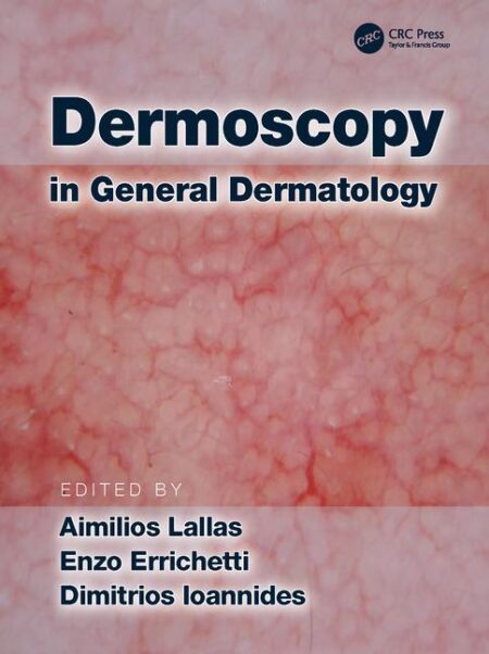 Dermoscopy in General Dermatology 2019