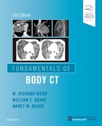 Fundamentals of Body CT 5/E 2020