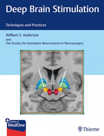 Deep Brain Stimulation: Techniques and Practices 2019