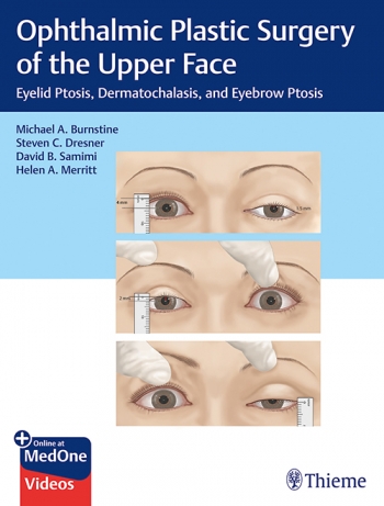 Ophthalmic Plastic Surgery of the Upper Face: Eyelid Ptosis, Dermatochalasis, and Eyebrow Ptosis 2020