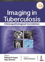 Imaging in Tuberculosis: Clinicopathological Correlation 2019