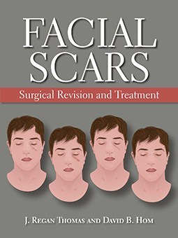 Facial Scars: Surgical Revision and Treatment  2019