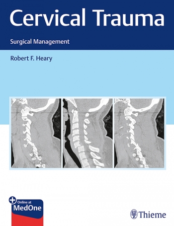 Cervical Trauma: Surgical Management 2019