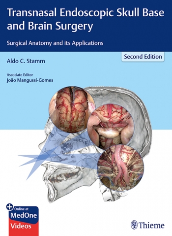 Transnasal Endoscopic Skull Base and Brain Surgery: Surgical Anatomy and its Applications 2/E 2019
