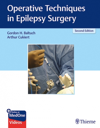 Operative Techniques in Epilepsy Surgery 2/E 2020