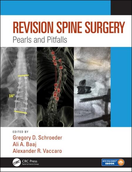 Revision Spine Surgery: Pearls and Pitfalls 2020