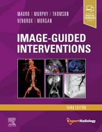 Image-Guided Interventions: Expert Radiology Series 3/E 2021