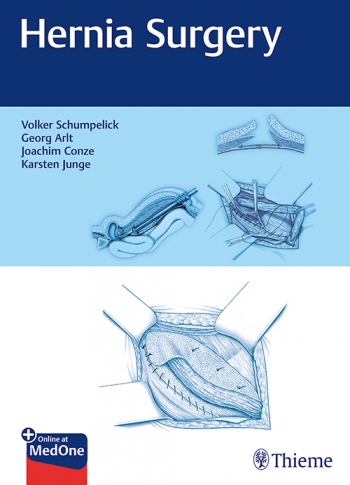 Hernia Surgery 2019