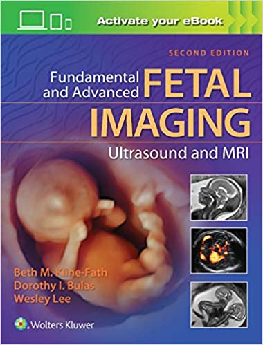 Fundamental and Advanced Fetal Imaging Ultrasound and MRI 2/E 2021
