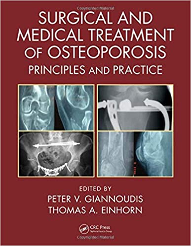 Surgical and Medical Treatment of Osteoporosis: Principles and Practice 2020