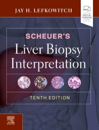 Scheuer's Liver Biopsy Interpretation 10/E 2021