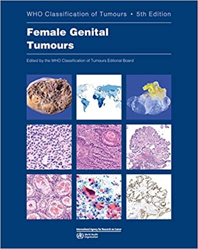 Female Genital Tumours: WHO Classification of Tumours  5/E  2020