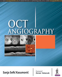 OCT Angiography 2019