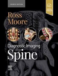 Diagnostic Imaging: Spine 4/E 2021