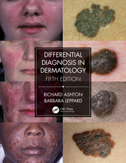 Differential Diagnosis in Dermatology 5/E 2021