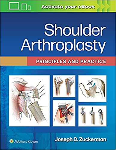 Shoulder Arthroplasty: Principles and Practice 2022
