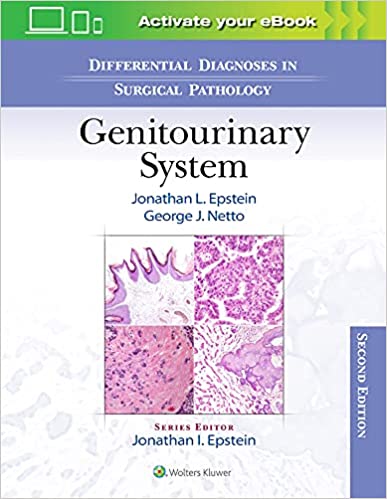 Differential Diagnoses in Surgical Pathology: Genitourinary System 2/E 2022