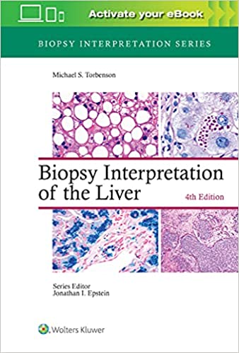 Biopsy Interpretation of the Liver (Biopsy Interpretation Series) 4/E 2022