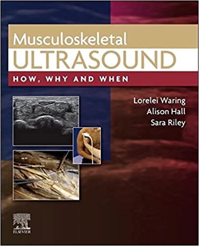 Musculoskeletal Ultrasound: How, Why and When 2022