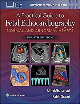 A Practical Guide to Fetal Echocardiography: Normal and Abnormal Hearts 4/E 2022