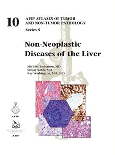 Non-Neoplastic Diseases of the Liver 2022