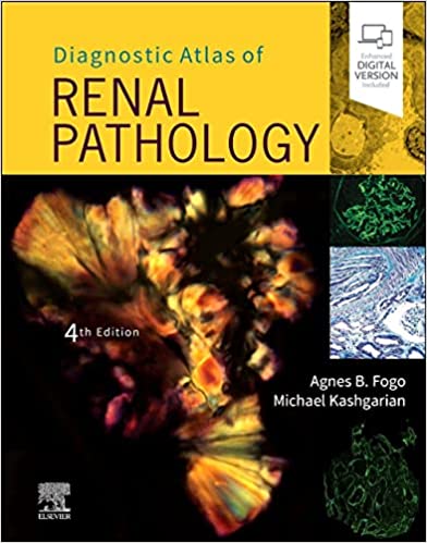 Diagnostic Atlas of Renal Pathology 4/E 2022
