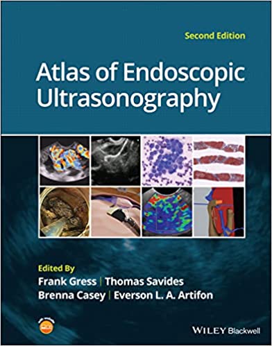 Atlas of Endoscopic Ultrasonography 2/E 2022