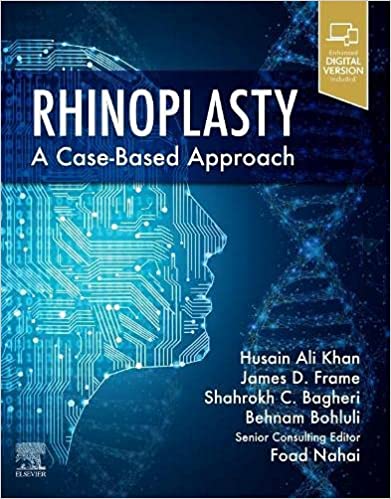 Rhinoplasty: a Case-based approach 2023
