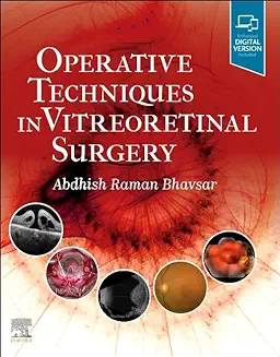 Operative Techniques in Vitreoretinal Surgery 2023