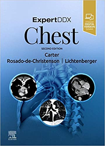 ExpertDDx: Chest 2/E 2020