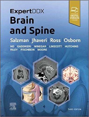ExpertDDx: Brain and Spine 3/E 2023