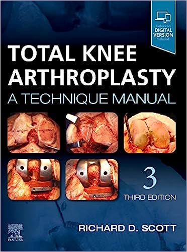 Total Knee Arthroplasty: A Technique Manual 3/E