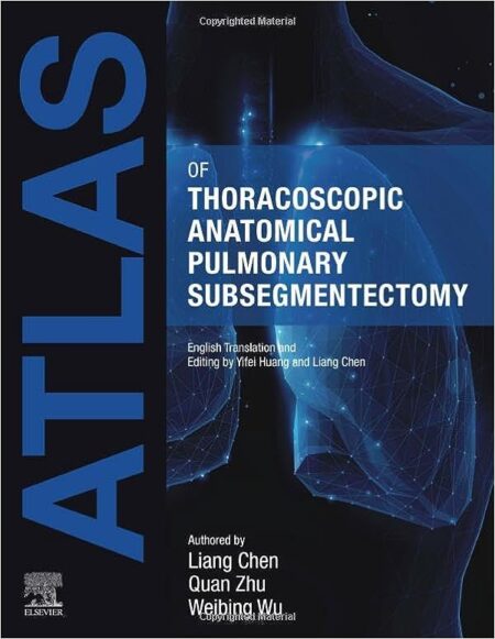 Atlas of Thoracoscopic Anatomical Pulmonary Subsegmentectomy 2023
