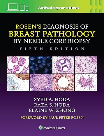 Rosen's Diagnosis of Breast Pathology by Needle Core Biopsy 5/E 2024