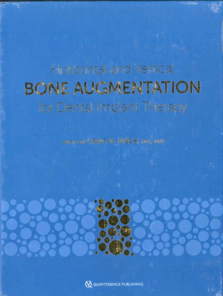 Horizontal and Vertical Bone Augmentation for Dental Implant Therapy