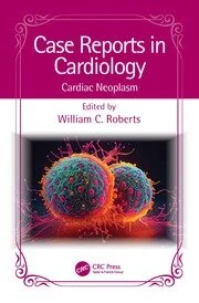 Case Reports in Cardiology : Cardiac Neoplasm 2024