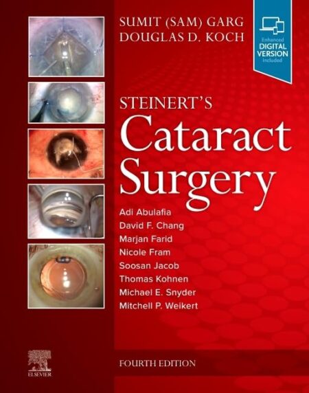Steinerts Cataract Surgery 4/E 2023