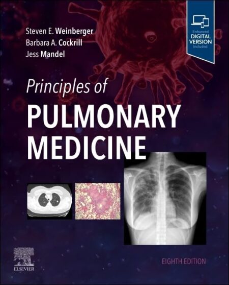 Principles of Pulmonary Medicine 8/E 2024